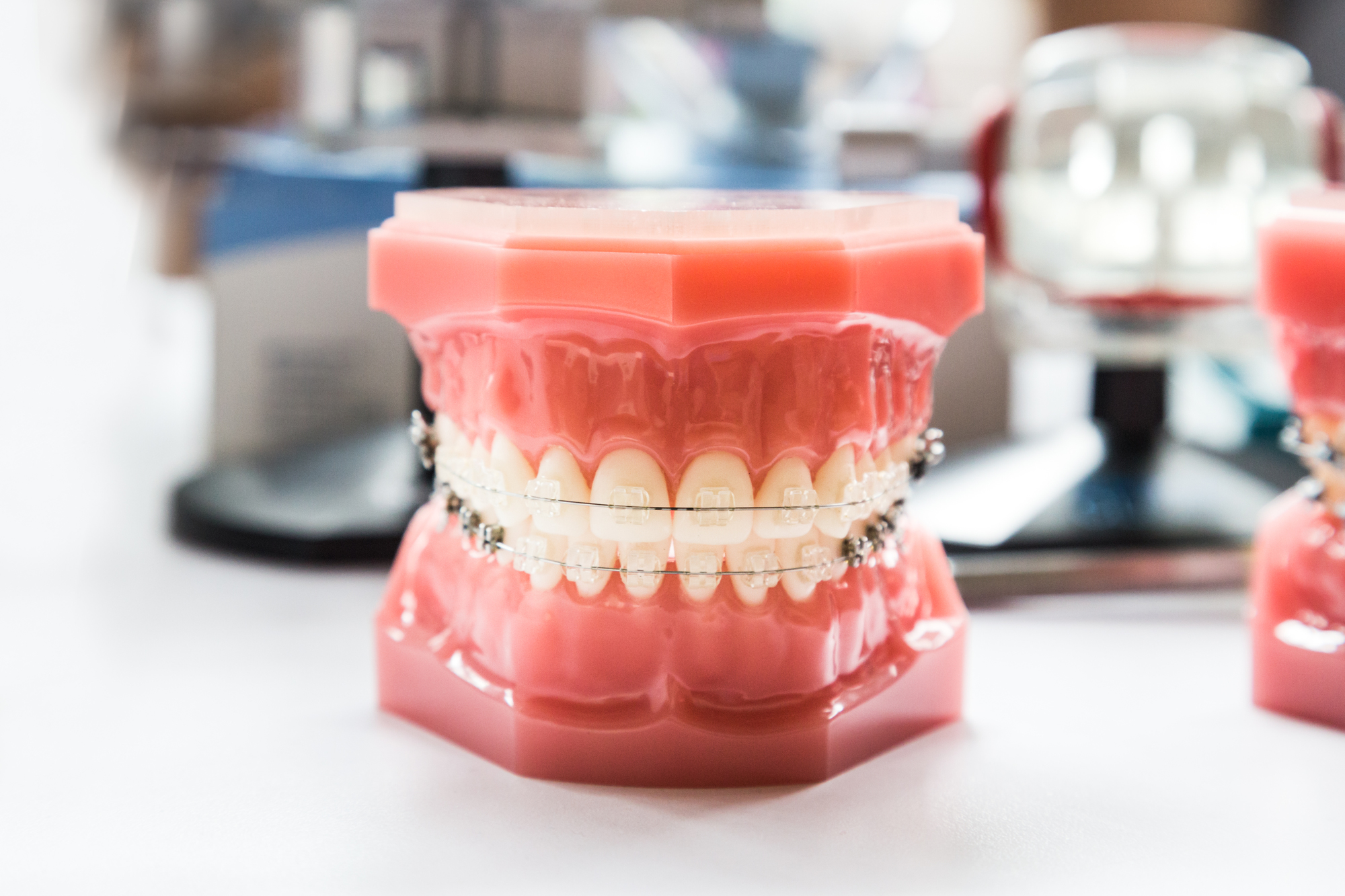 矯正装置 広島で「安い・人気・おすすめ」の抜かない矯正専門医院